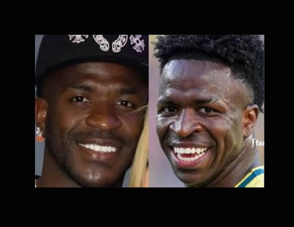 Vinícius Jr. sorprende con su nueva imagen tras someterse a cirugía estética en Brasil